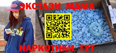 шишки Можга